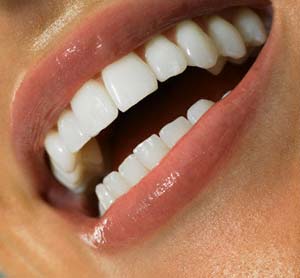 Средства, применяемые для домашнего отбеливания зубов