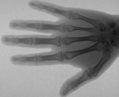 Рентгеновские лучи в медицине